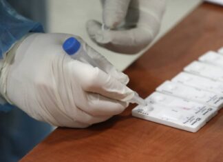 ΡΕΝΤΗΣ: Δωρεάν rapid tests την Πέμπτη – Δείτε σε ποια σημεία