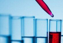 ΕΞΕΤΑΣΕΙΣ ΑΙΜΑΤΟΣ: Να τι σημαίνει κάθε εξέταση στη γενική αίματος και τι να κοιτάς