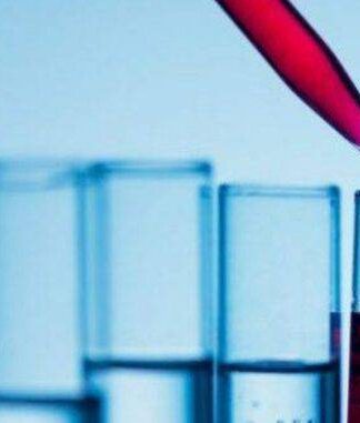 ΕΞΕΤΑΣΕΙΣ ΑΙΜΑΤΟΣ: Να τι σημαίνει κάθε εξέταση στη γενική αίματος και τι να κοιτάς