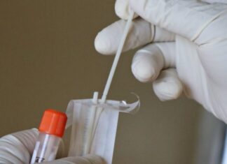 Θωμαΐδης: Τα self test ΔΕΝ είναι ιατρική πράξη. Μάθετε λοιπόν, “αδαείς ,ξερόλες και ημιμαθείς”