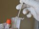Θωμαΐδης: Τα self test ΔΕΝ είναι ιατρική πράξη. Μάθετε λοιπόν, “αδαείς ,ξερόλες και ημιμαθείς”