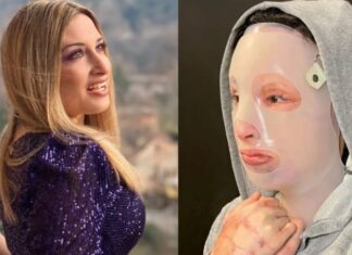 Σοκάρει η Ιωάννα Παλιοσπύρου: Δημοσίευσε φωτογραφίες από το χειρουργείο μετά την επίθεση με βιτριόλι – Σκληρές εικόνες