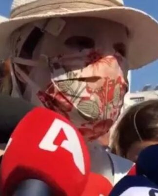 Σοκ! Η Ιωάννα κινδύνεψε να τυφλωθεί!