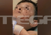 Λαγονήσι: «Ο σκύλος θα τον είχε σκοτώσει» λέει η μητέρα του 14χρονου