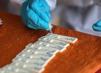 Κορονοϊός: 51.824 κρούσματα, 130 θάνατοι και 88 διασωληνωμένοι