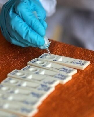 Κορονοϊός: 51.824 κρούσματα, 130 θάνατοι και 88 διασωληνωμένοι