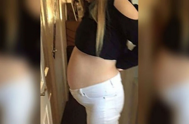 22χρονη νόμιζε ότι ήταν 8 μηνών έγκυος... Όταν οι γιατροί ανακάλυψαν τι πραγματικά μεγάλωνε στην κοιλιά της έπαθαν σοκ