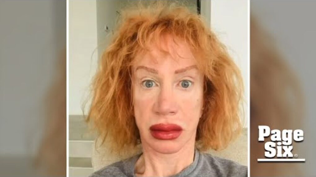 Kathy Griffin shocks fans with dramatically swollen lips after tattoo procedure