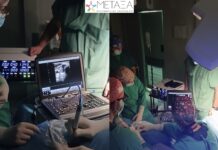 Νοσοκομείο «Μεταξά»: Εφαρμόστηκε για πρώτη φορά στο ΕΣΥ η θερμική κατάλυση θυρεοειδικών όζων με μικροκύματα