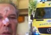 Σοκ: Τον ξυλοκόπησαν σε ιδιωτικό ιατρείο επειδή έκανε μια απλή παρατήρηση